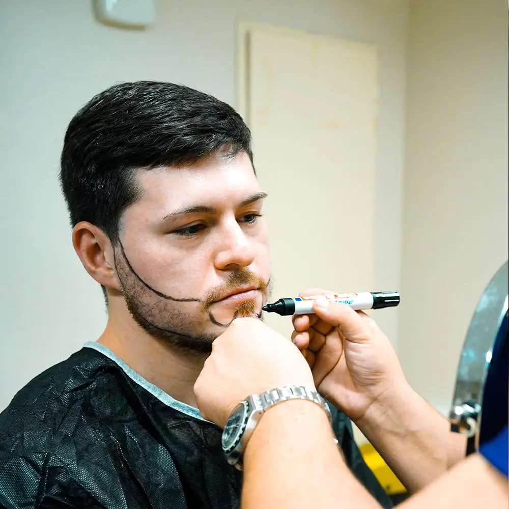 Beard Hair Transplant