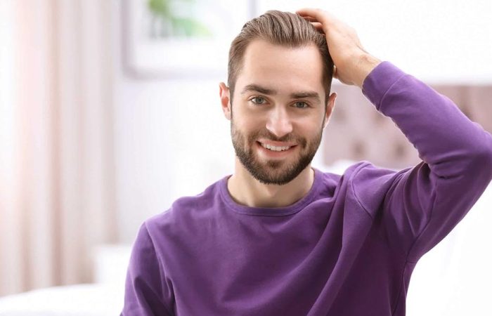 Traşsız Saç Ekimi 16 Unshaven Hair Transplant Hermest 1