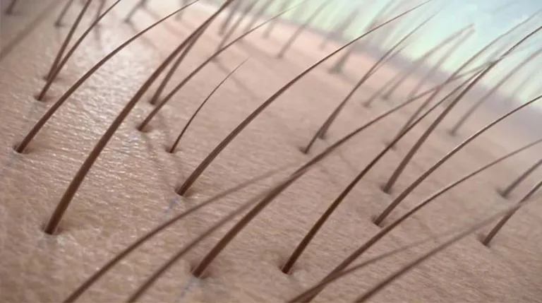Hair Loss Reversal