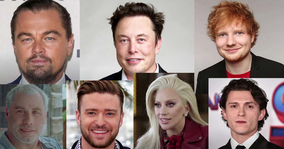Celebrity Hair Transplants