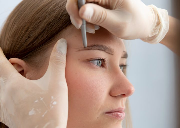 Eyebrow Transplant: Cost, Recovery & Natural Results 5 Hair Transplantation for Eyelashes and Eyebrows