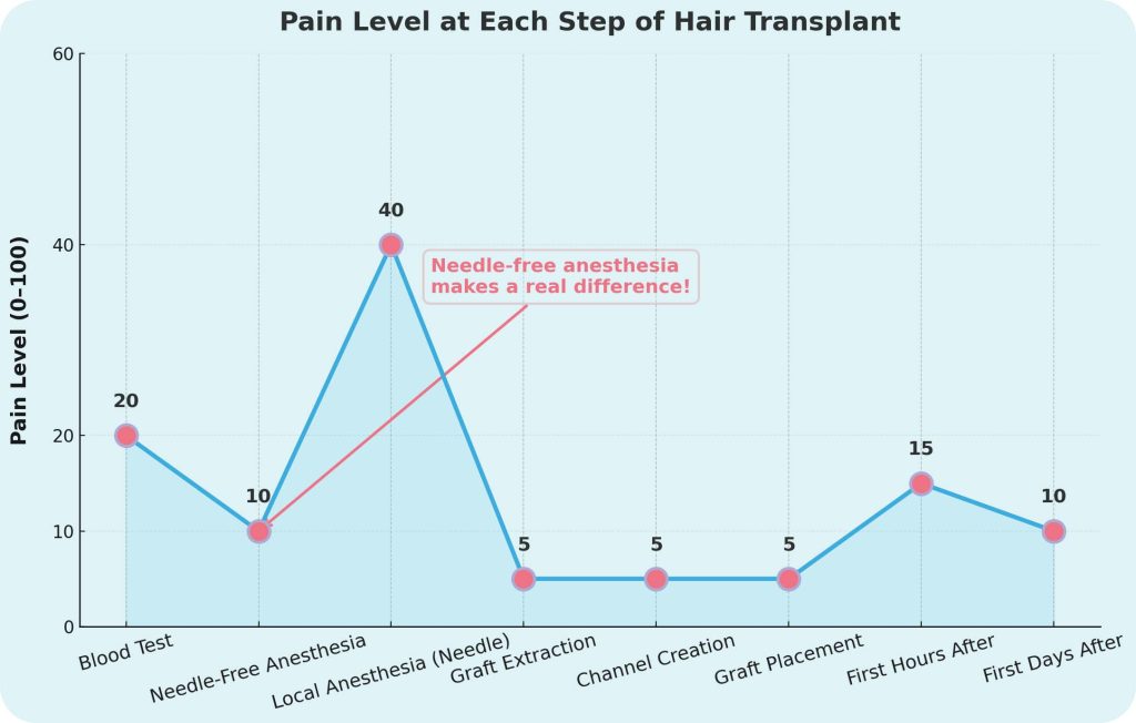 Is a Hair Transplant Surgery Painful? 2 Table illustrating the expected pain level for each phase of a hair transplant, including the procedure and post-op recovery period