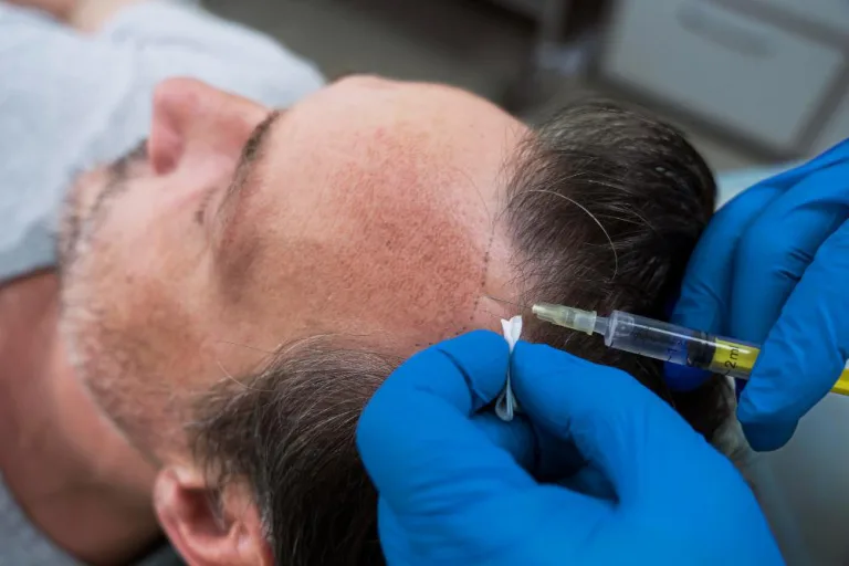 Hair Loss Come From