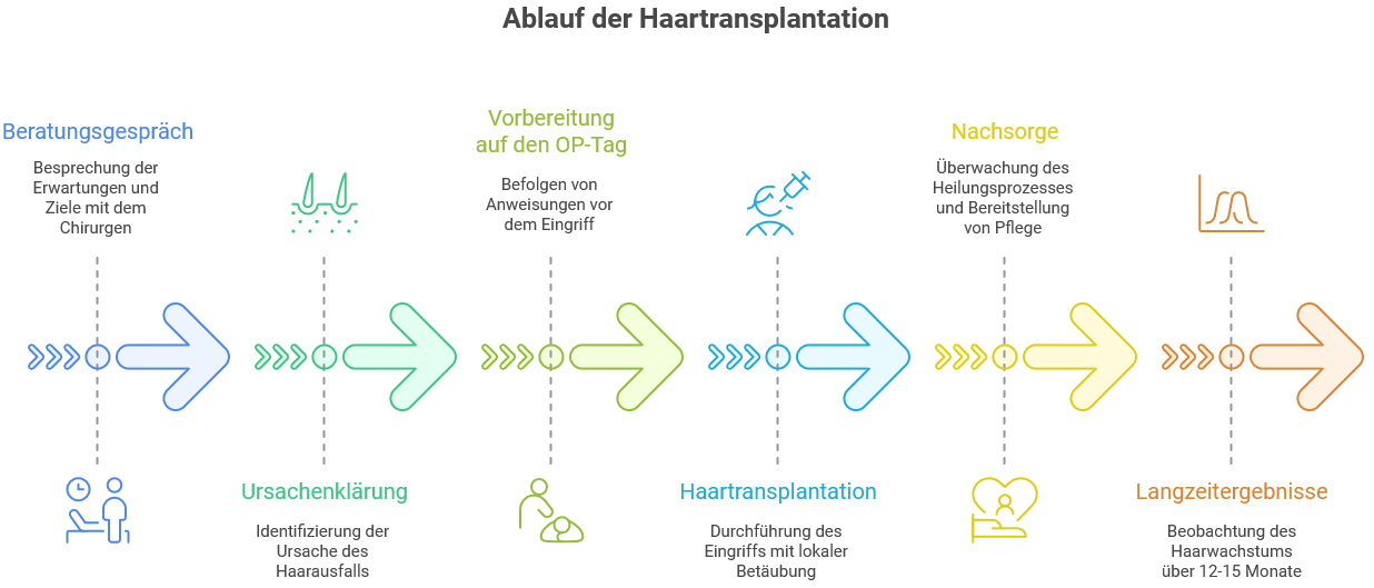 Ablauf Haartransplantation – Ihr Fahrplan zu gesundem Haar 2 Grafische Darstellung der Ablaufs einer Haartransplantation