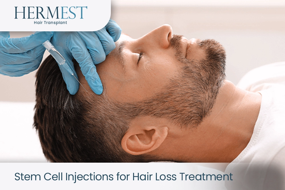 Stem Cell Injections for Hair Loss Treatment