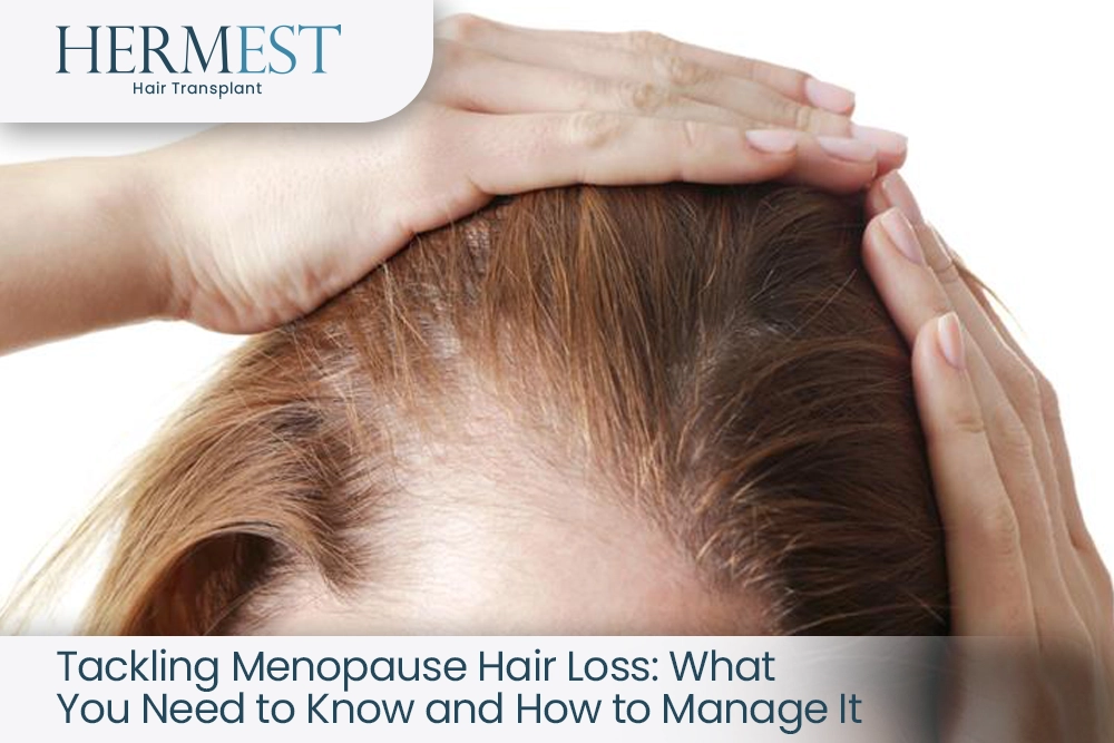 Tackling Menopause Hair Loss