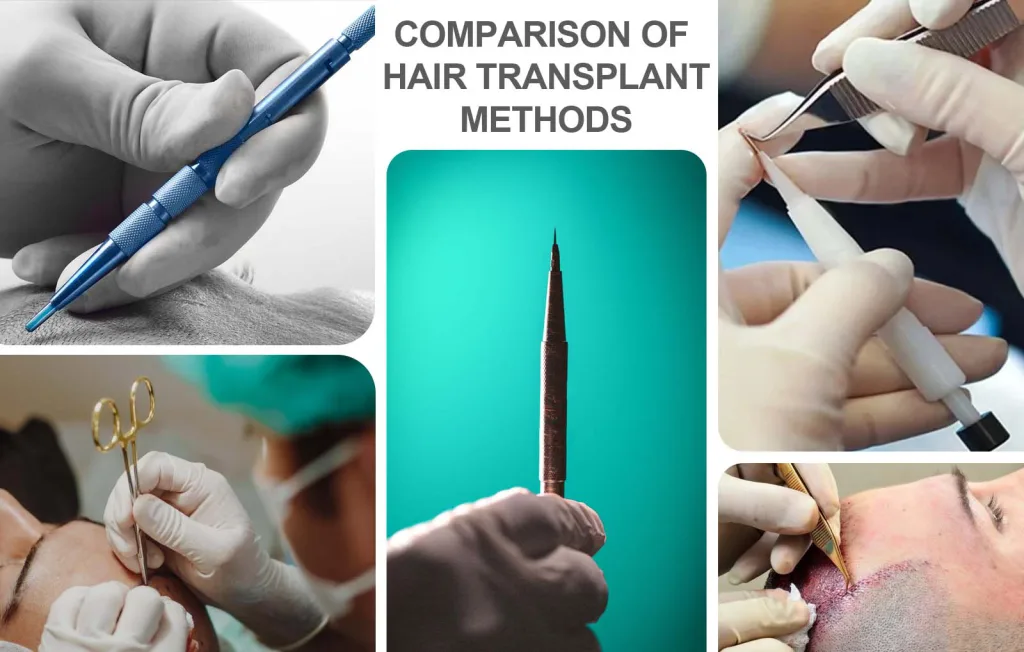 Collage of FUE, Sapphire FUE and DHI hair transplant tools used to compare transplant methods