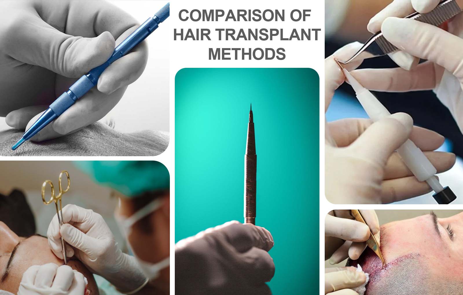 A comparison chart illustrating the effectiveness, patient satisfaction rates, and success rates of different hair transplant methods, including Unique FUE, Sapphire FUE, DHI, Slit FUE, Robotic FUE, and FUT