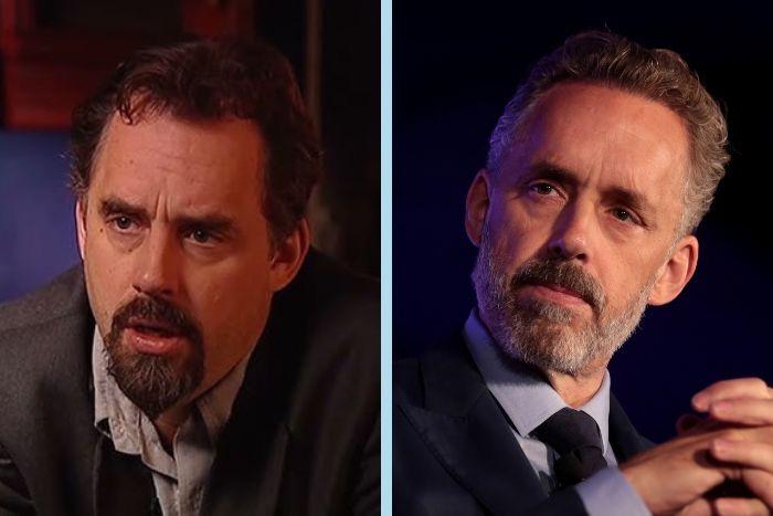 Jordan Peterson Hair Transplant 8 jordan peterson hair transplant