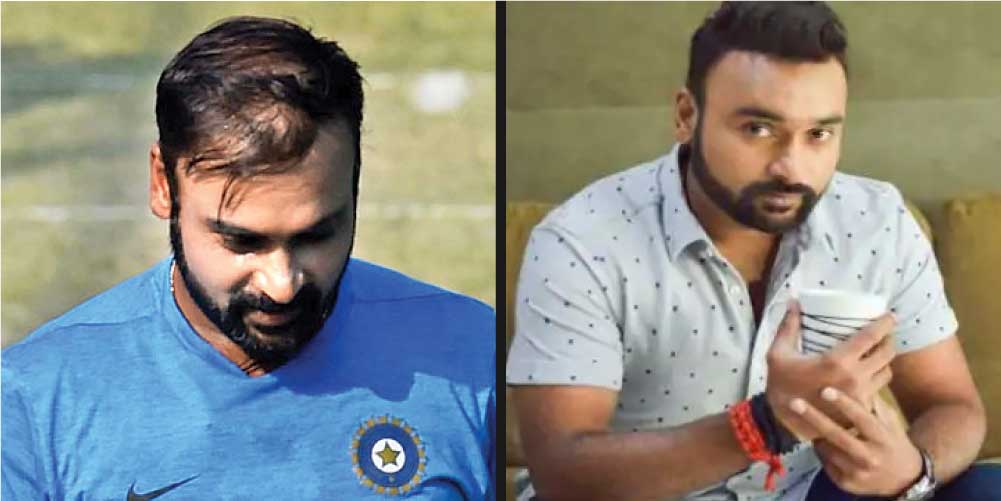 Celebrity Hair Transplants: 45 Transformations & Success Stories 4 Amit Mishra hair transplant