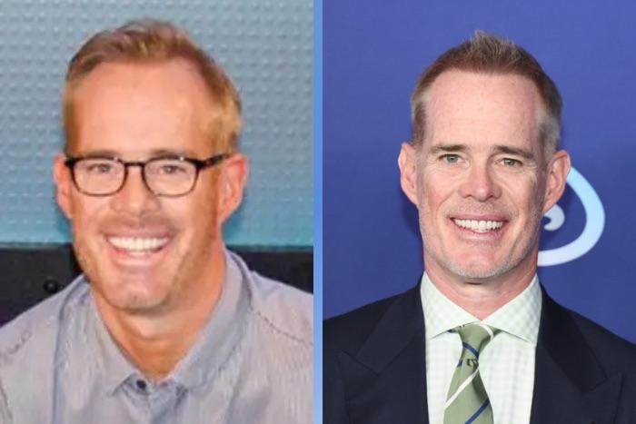 Celebrity Hair Transplants: 45 Transformations & Success Stories 23 Joe Buck