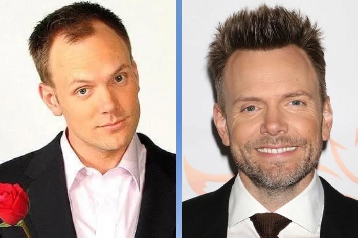 Celebrity Hair Transplants: 45 Transformations & Success Stories 25 Joel McHale