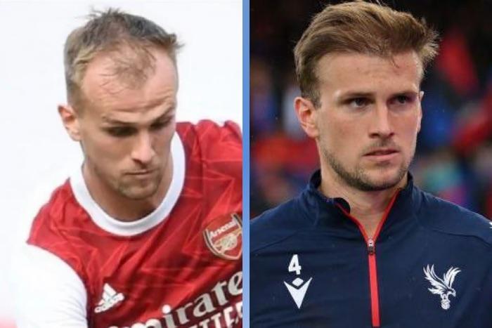 Celebrity Hair Transplants: 45 Transformations & Success Stories 38 Rob Holding
