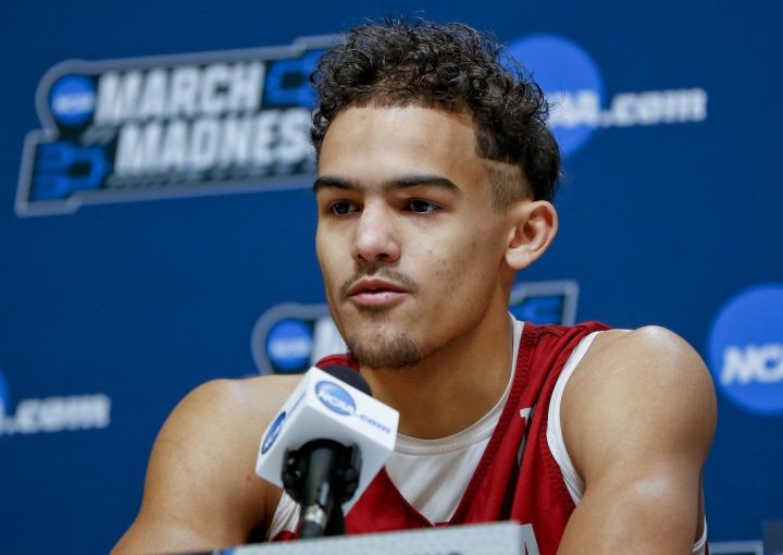 Trae Young hair transplant 3 Trae Young hair transplant