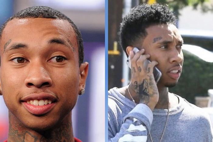 Celebrity Hair Transplants: 45 Transformations & Success Stories 43 Tyga