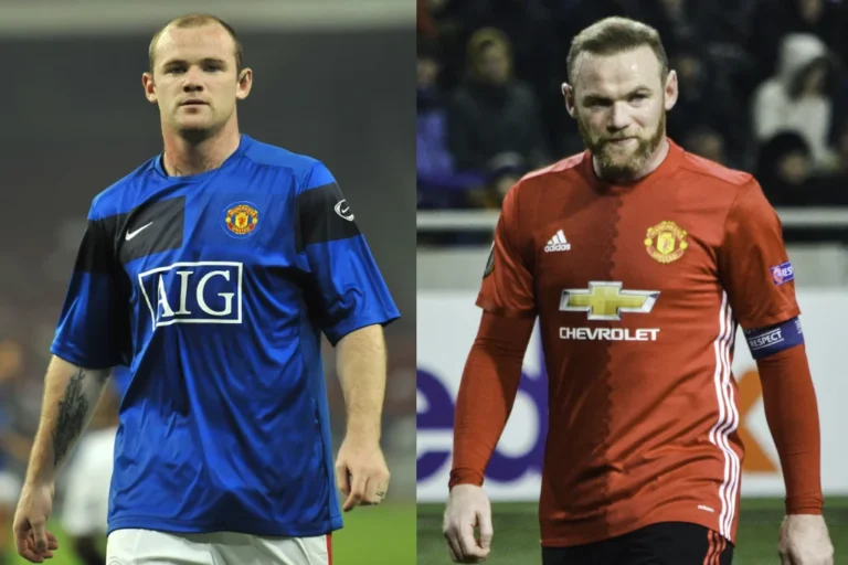 hair transplant wayne rooney