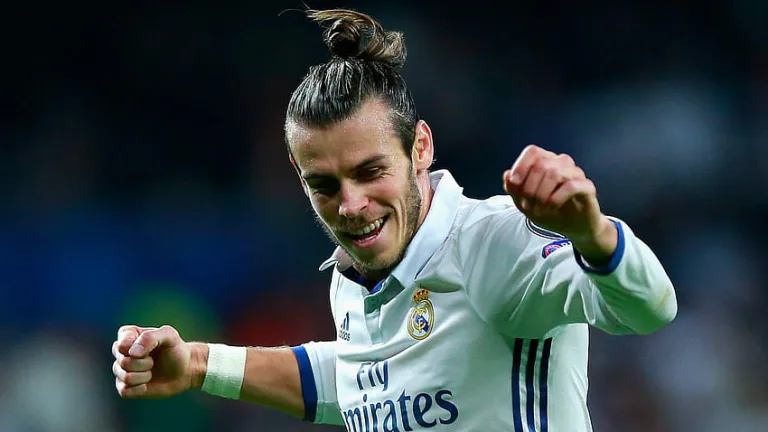 gareth bale hair transplant