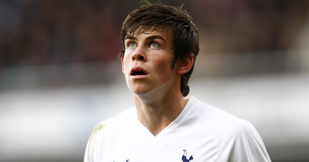 Gareth Bale Hair Transplant 2 gareth bale young
