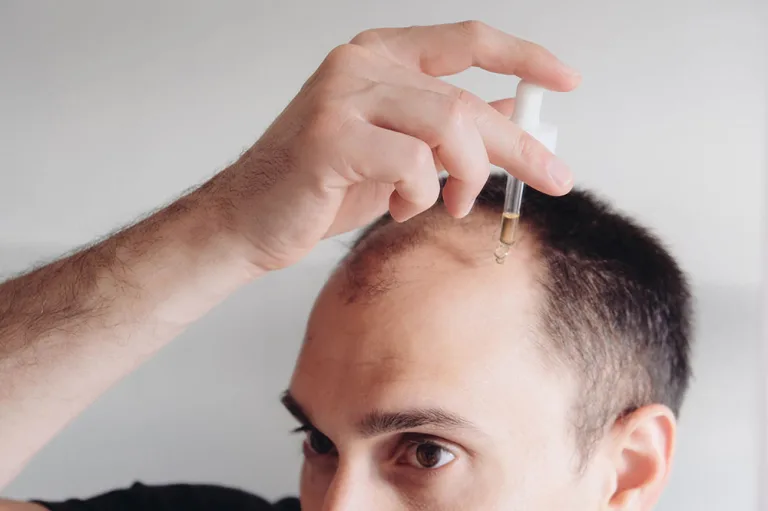 bataba oil for hair loss