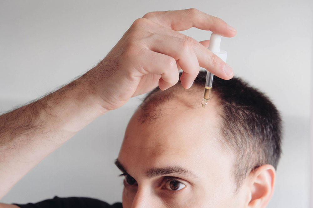 Natural Remedies for Hair Loss | Home & Herbal Treatments 4 bataba oil for hair loss
