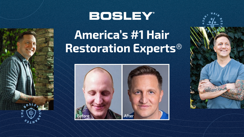 bosley hair transplant
