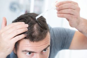 Dutasteride Side Effects: Are They Permanent or Reversible? 2 dutasteride side effects