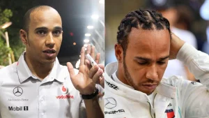 lewis hamilton hairline