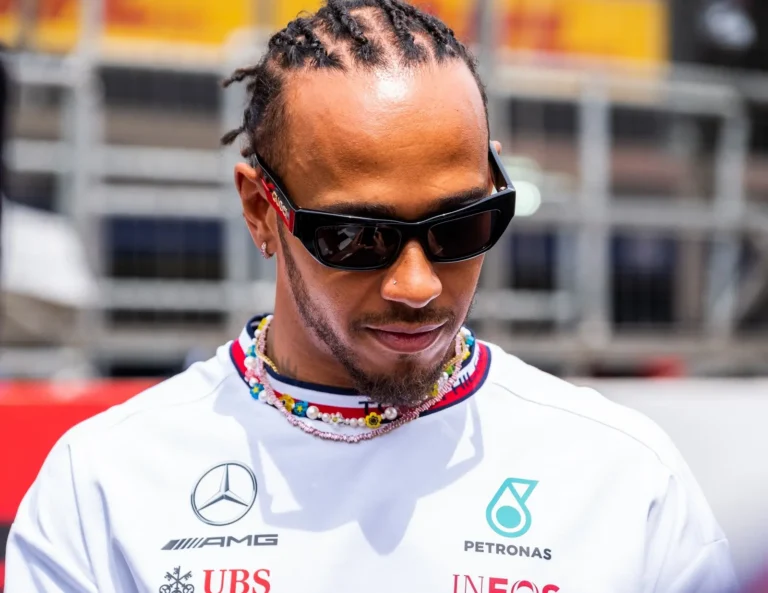 lewis hamilton possible hair transplant