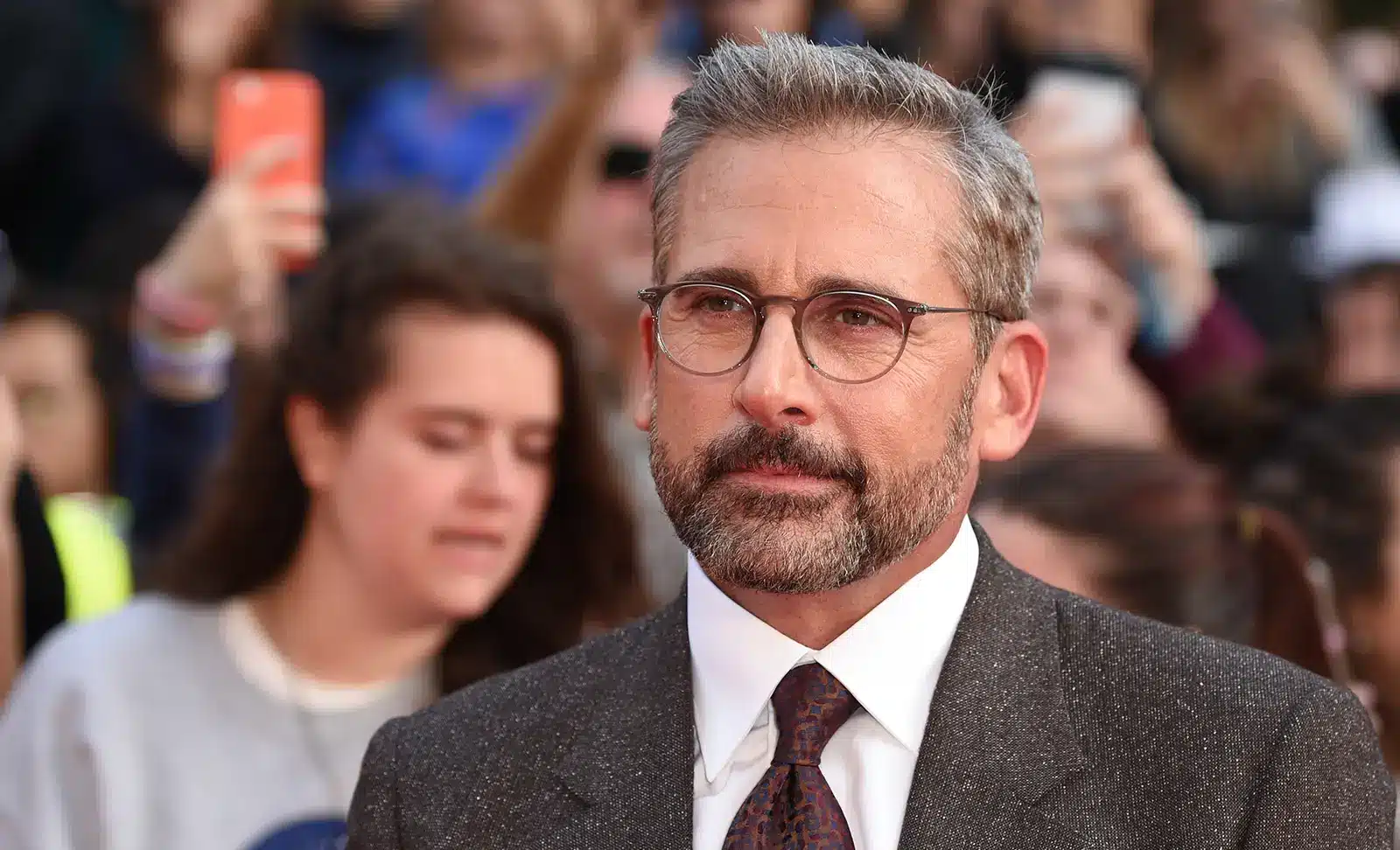 steve carell hair transplant review