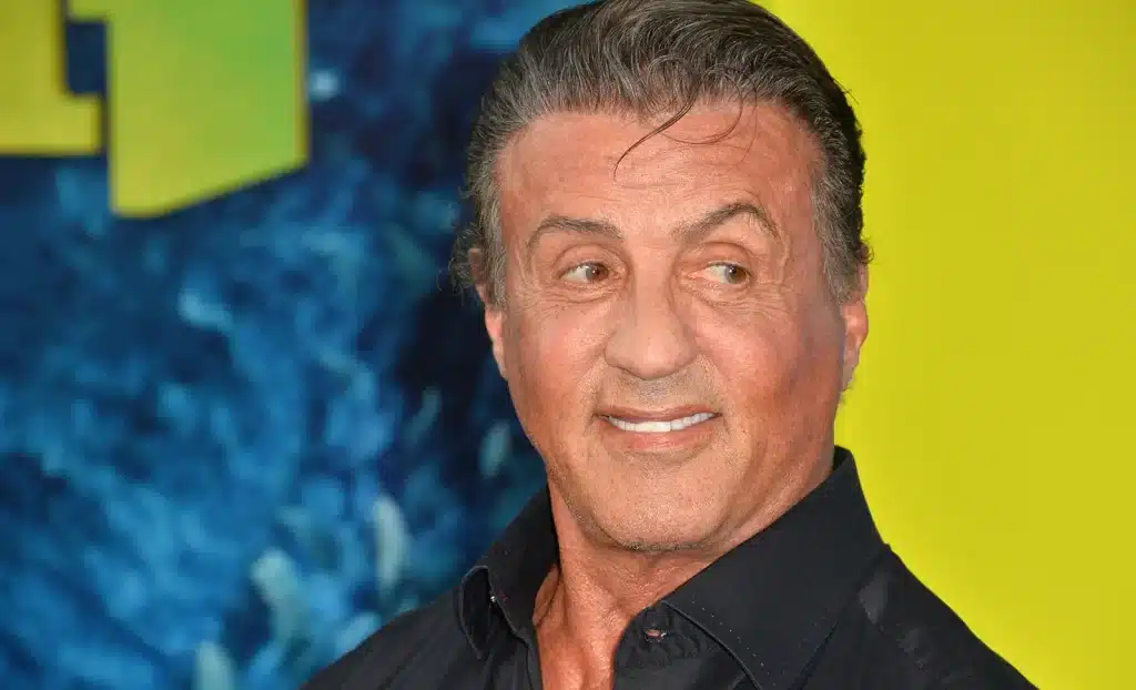 Sylvester Stallone Hair Transplant