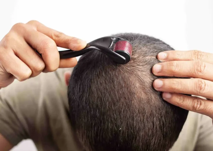 Derma Roller for Hair