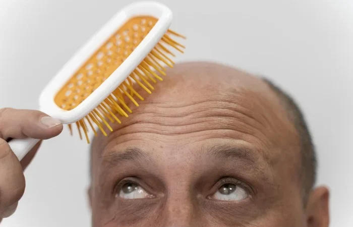 Mann mit Haarausfall kämmt sich die Glatze