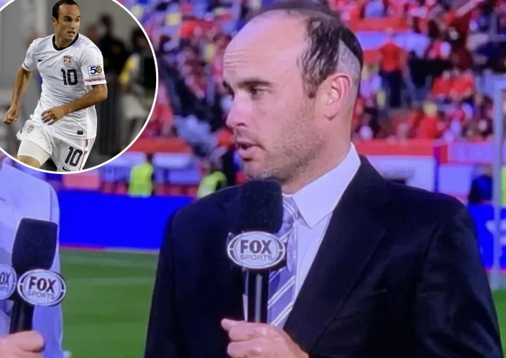 Landon Donovan Hair Transplant: Timeline, Cost & Results 2 Landon Donovan Hair Transplant