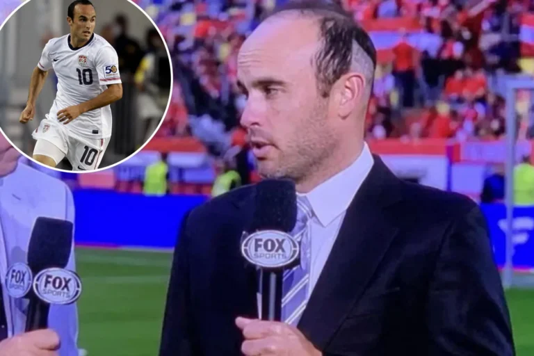 Landon Donovan Hair Transplant
