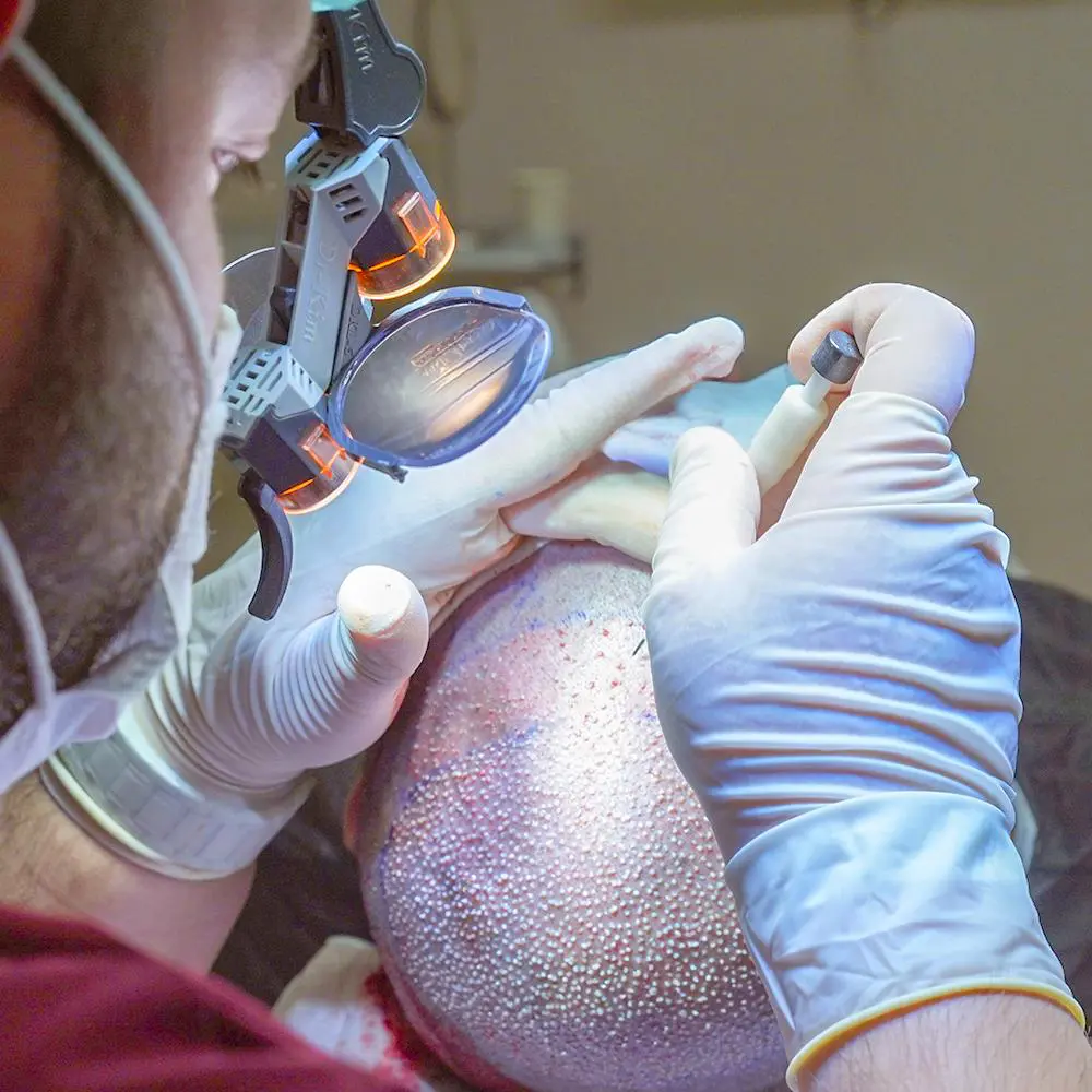 Best Proven Hair Transplant Methods in 2026