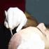 Unshaven Hair Transplant 7 hair transplant grooving
