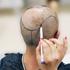 Unshaven Hair Transplant 4 hair transplant planning