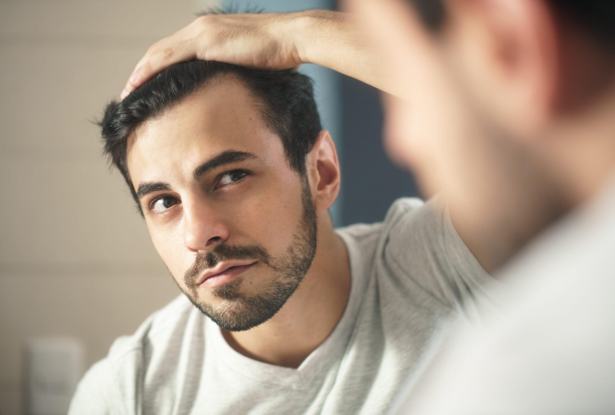 Haartransplantation Geheimratsecken