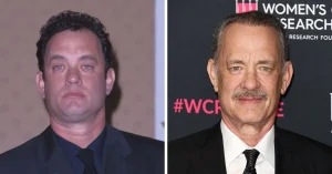Tom Hanks Hair Transplant: Before & After Analysis 2 tom hanks hair