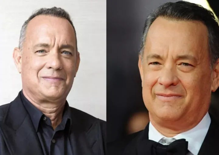 tom hanks hair transplant