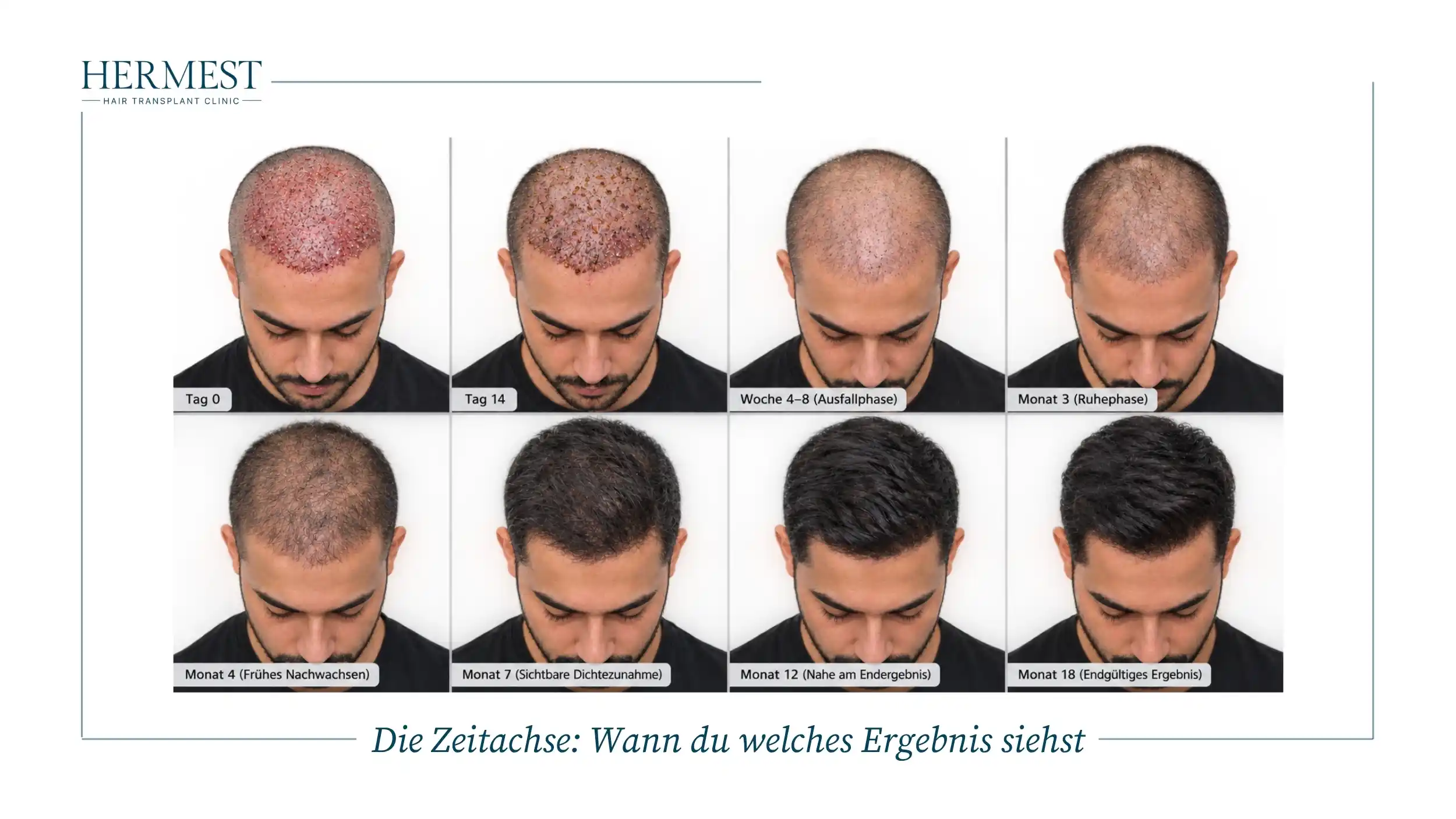 Die Zeitachse Wann du welches Ergebnis siehst