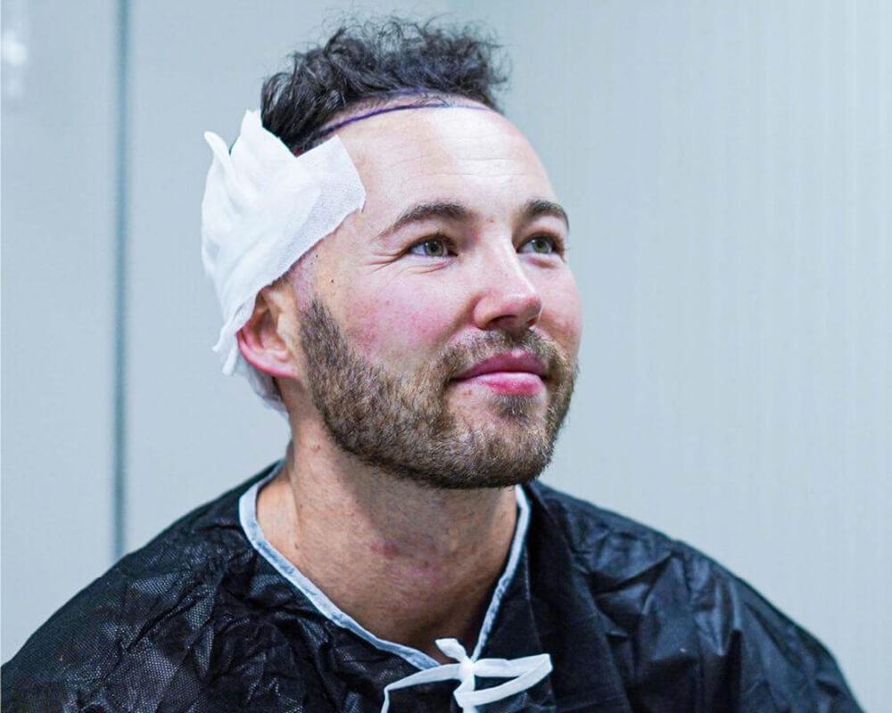 Get Your Best Hair Transplant with Hermest in Turkey 43 hermest-dhi-hair-transplant