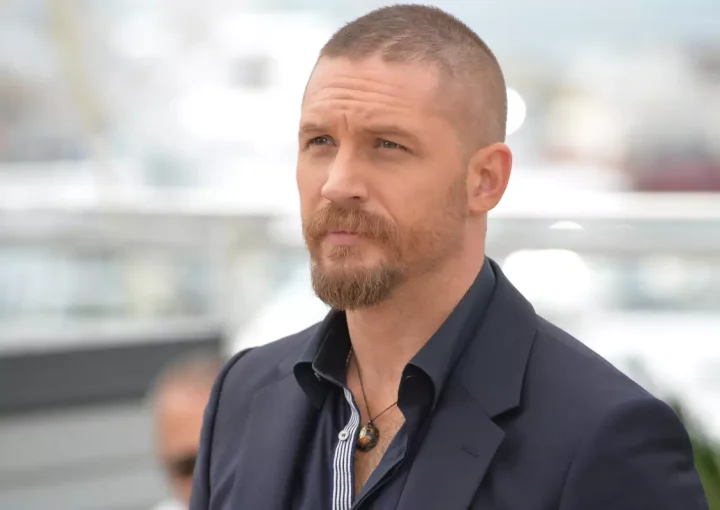 tom hardy hair transplant