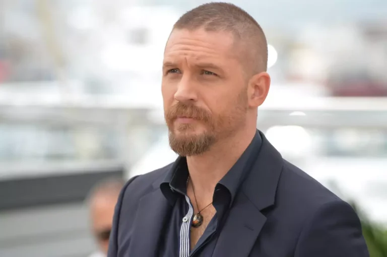 tom hardy hair transplant