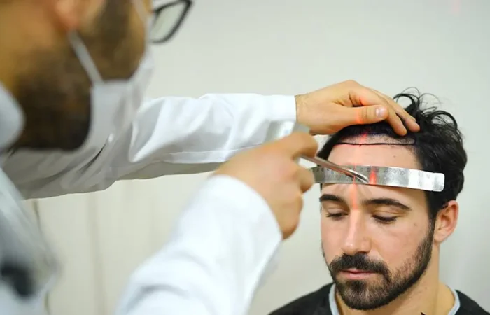 Haartransplantation Beratung – Worauf achten? 3 Haartransplantation Beratung