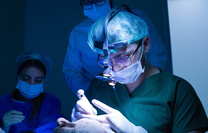 Haartransplantation Schwellung – Ist das gefährlich? 5 Haartransplantation Schwellung