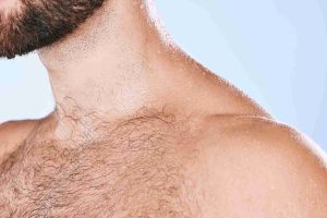 Haartransplantation ohne Eigenhaar – Möglichkeiten und Risiken 2 Körperhaare eignet sich nicht für Haartransplantation