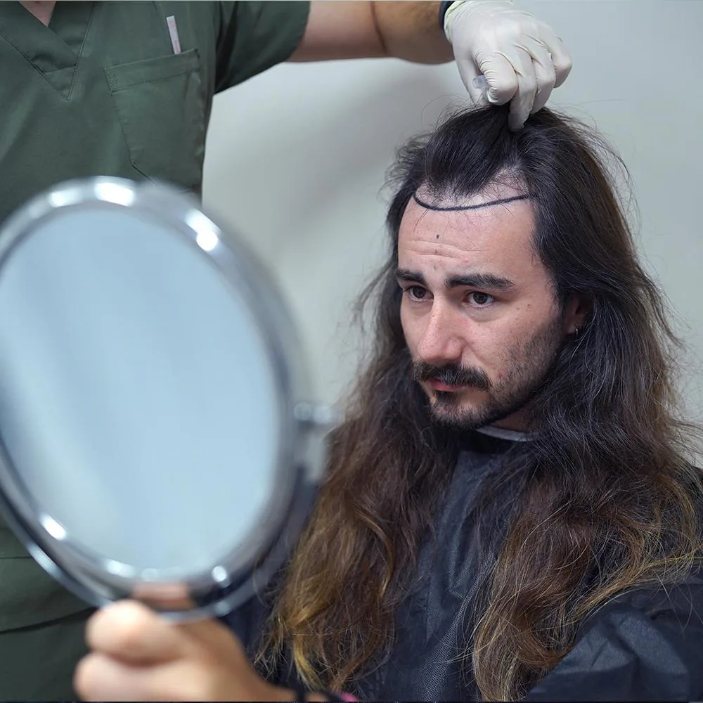 Long-haired man checking his thinning hairline in a mirror as a new hairline is drawn on
