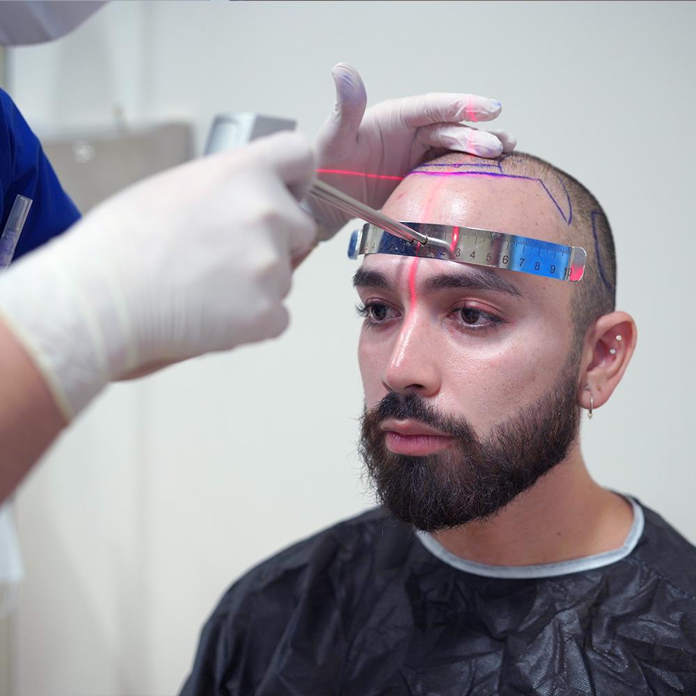 Am I a Good Candidate for Hair Transplant? Complete Eligibility Guide 8 causes of hair loss hermest