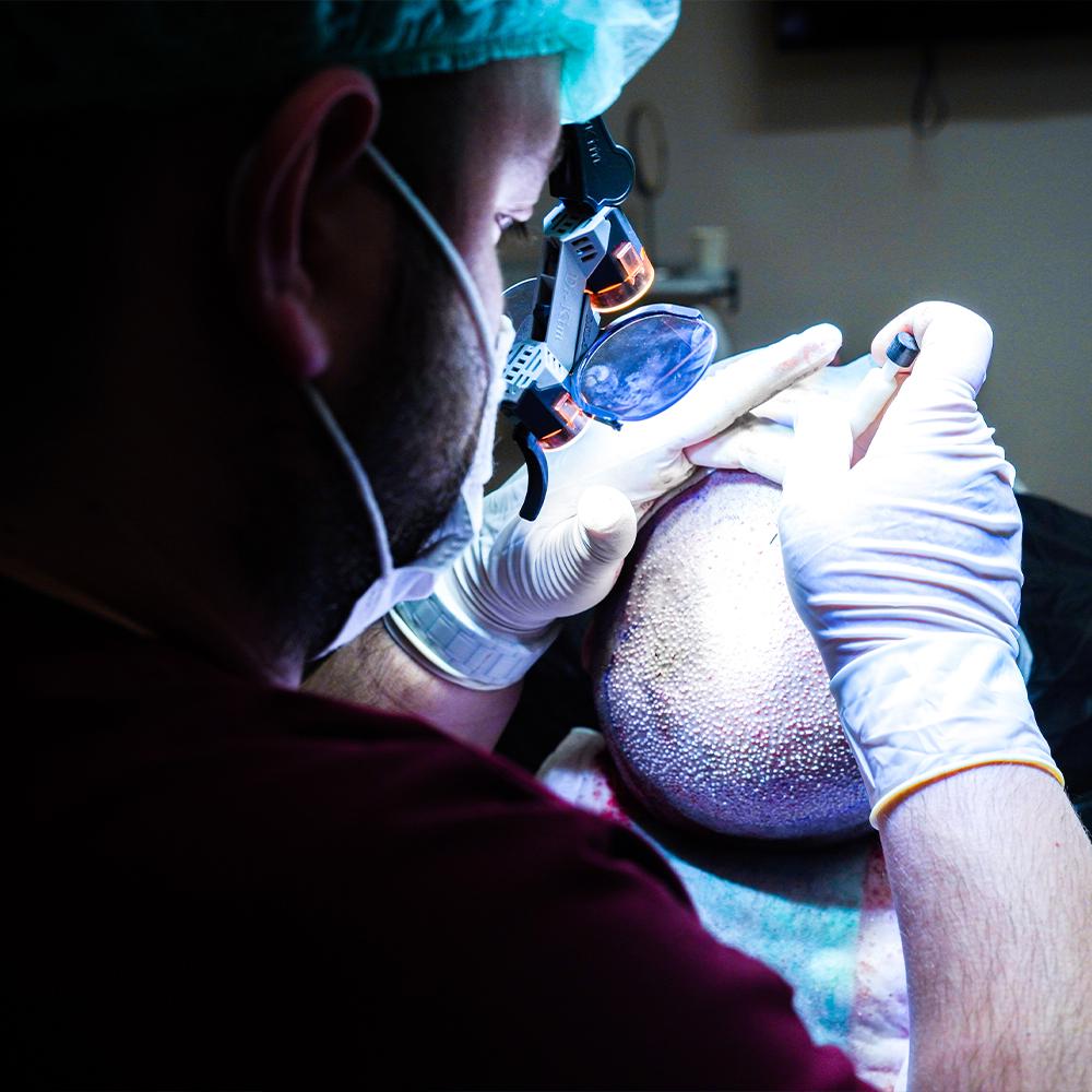 dhi hair implant close up turkey